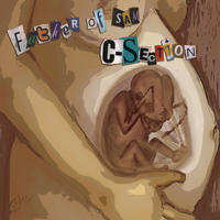C-Section by Father of Sam