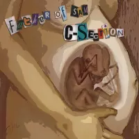 [C-Section by Father of Sam]